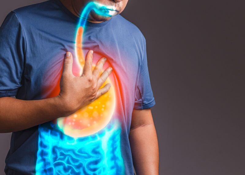 Cosa non mangiare se si soffre di reflusso gastroesofageo